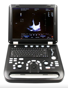 Échographe Doppler couleur portable CMS1700C Vet Con Tec avec sondes convexes et linéaires pour la détection de la gestation - Product Image 1