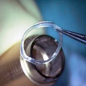 Equipo Oftálmico de Trépano de Doble Hoja JACOB CAIRS de Fabricación Científica y Quirúrgica... - Product Image 5