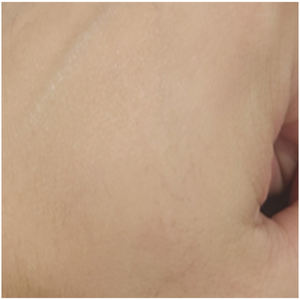 Suero en Ampolla Derivado de Plantas con Ácido Hialurónico, Antienvejecimiento y Blanqueador, Hecho en Corea, Ingrediente Patentado, Suministro ODM/AL POR MAYOR - Product Image 4