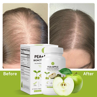 Disponible en OEM/ODM : Soutien Nutritionnel Capillaire pour la Repousse, Réduction de la Calvitie, Réduction de la Chute des Cheveux, Épaississement des Cheveux – Pour Femmes et Hommes