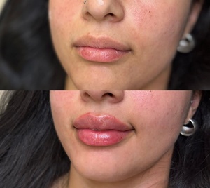 Applicateur métallique de récipient à presser rose Acide hyaluronique Brillant à lèvres plus dodu Marque privée - Product Image 5