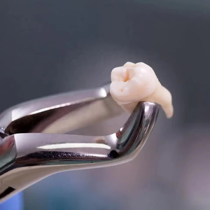 ชุดเครื่องมือผ่าตัดทางทันตกรรม 10 ชิ้น คุณภาพสูง ได้รับการรับรองมาตรฐาน CE ระดับ Class I สำหรับการถอนฟันผู้ใหญ่ คีมถอนฟันแบบใช้มือสำหรับทันตแพทย์ - Product Image 3