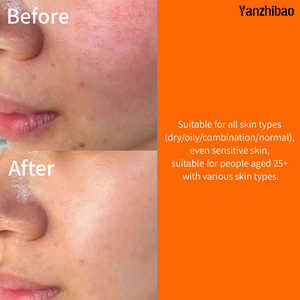 เซรั่มวิตามินซี 20% สำหรับผิวหน้า ผสมไฮยาลูรอนและกรดอะมิโน ช่วยเติมความชุ่มชื้นและกระชับผิว ลดเลือนริ้วรอยและต่อต้านวัย - Product Image 5