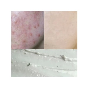 Máscara de modelado de diatomita de árbol de té para el cuidado de la piel Premium Etiqueta privada Coreana OEM ODM Productos de belleza al por mayor - Product Image 2