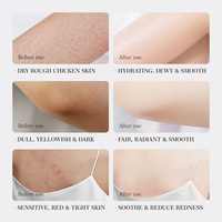 Crème Blanchissante Forte et Efficace 1KG Visage Cou Main Pied Sans Effets Secondaires pour les Taches Sombres Peau Noire Crème Blanchissante Décolorante