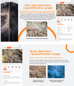Appareil d'analyse 2-en-1 pour la peau et les cheveux, analyseur de problèmes cutanés et capillaires avec 1 poignée - Product Image 6
