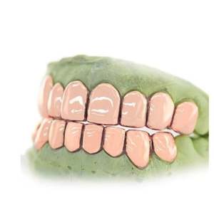 18K or argent et or rose dents Grillz haut bas Hip Hop bijoux Moissanite pierre pour hommes et femmes Fine Piercing bijoux - Product Image 5