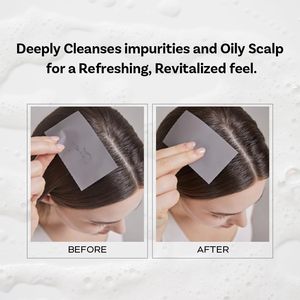 Shampooing Unisexe Apothe pour Cheveux Gras, Contrôle du Sébum du Cuir Chevelu, Formule Concentrée Liquide 300ml, Nettoyage en Profondeur, Traitement Rafraîchissant - Product Image 2
