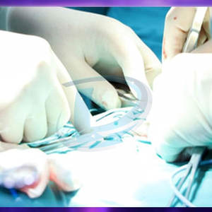 Professional Made <b>Scalpel</b> <b>Knives</b> Wholesale Low Price <b>Scalpel</b> <b>Knives</b> High Quality <b>Scalpel</b> <b>Knives</b> - Product Image 5