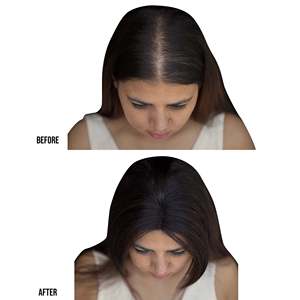 Extensiones de Cabello Humano Remy 100% Ultra-ligeras, Clip Less Scalp Topper 2.5x3 - Product Image 2