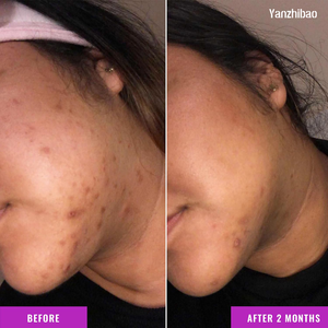 เซรั่มแก้ไขสีผิว-สูตรกรดทรานอกซามิกและไนอาซินาไมด์สำหรับจุดด่างดำ ฝ้า และสีผิวไม่สม่ำเสมอ - Product Image 4