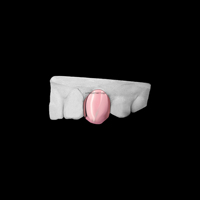 Capuchon en or Grillz à dent unique personnalisé fait à la main 10K/14K couvercle de dent en or pour les dents supérieures Style Hip Hop pour hommes et femmes