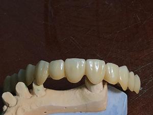 98x16mm STP blanc zircone bloc <span class=keywords><strong>prix</strong></span>, consommable <span class=keywords><strong>dentaire</strong></span> zircone bloc <span class=keywords><strong>dentaire</strong></span> en céramique pour cad cam zircon bloc - Product Image 5