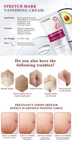 Crema para eliminar cicatrices y acné durante el embarazo para mujeres embarazadas Crema antienvejecimiento antiarrugas y reafirmante para el cuidado de la piel - Product Image 3