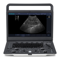 SonoScape E1V Sistema de Diagnóstico por Ultrasonido Portátil Veterinario en Blanco y Negro para Clínica Veterinaria y Uso en Granjas, Dispositivo de Imagenología en Blanco y Negro