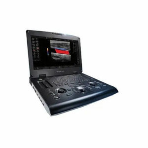 Appareil d'échographie GE Versana Active d'occasion - Product Image 1