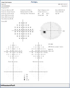 Analyseur de champ <span class=keywords><strong>visuel</strong></span> <span class=keywords><strong>Humphrey</strong></span> BIO-1000 de périmètre de projection ophtalmique en métal électrique - Product Image 3