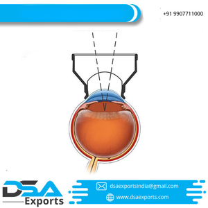 Lentille asphérique de haute qualité YAG Capsulotomie Diagnostic chirurgical Lentilles ophtalmiques OEM Soutien personnalisé Exportateur indien - Product Image 5