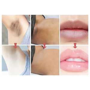 غسول تبييض نباتي عشبي تحت الإبط لمنطقة حميمية للنساء تبييض لطيف لتفتيح الحلمة للشفاه المهبلية - Product Image 5