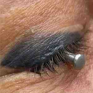 Surgical Stainless Steel Corneal <b>Eye</b> Shield with Chemical Resistant Full-Frame Design for Laser <b>Protection</b> - Product Image 5