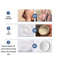 Etiqueta privada 40% Urea Vitamin E Cream Hydrating Organic para el cuidado de la piel de la cara Mano Pie Infundido con ingredientes minerales a base de hierbas