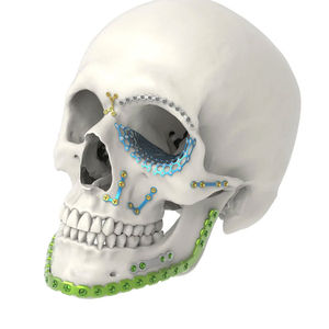 Juego de instrumentos de cirugía plástica maxilofacial personalizable, acero inoxidable y titanio para instrumentos quirúrgicos abdominales - Product Image 5