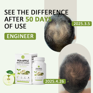 Píldoras Naturales a Base <span class=keywords><strong>de</strong></span> Hierbas <span class=keywords><strong>para</strong></span> el Crecimiento del Cabello, Suplemento Dietético, Fórmula Anticaída <span class=keywords><strong>para</strong></span> Adultos - Product Image 5