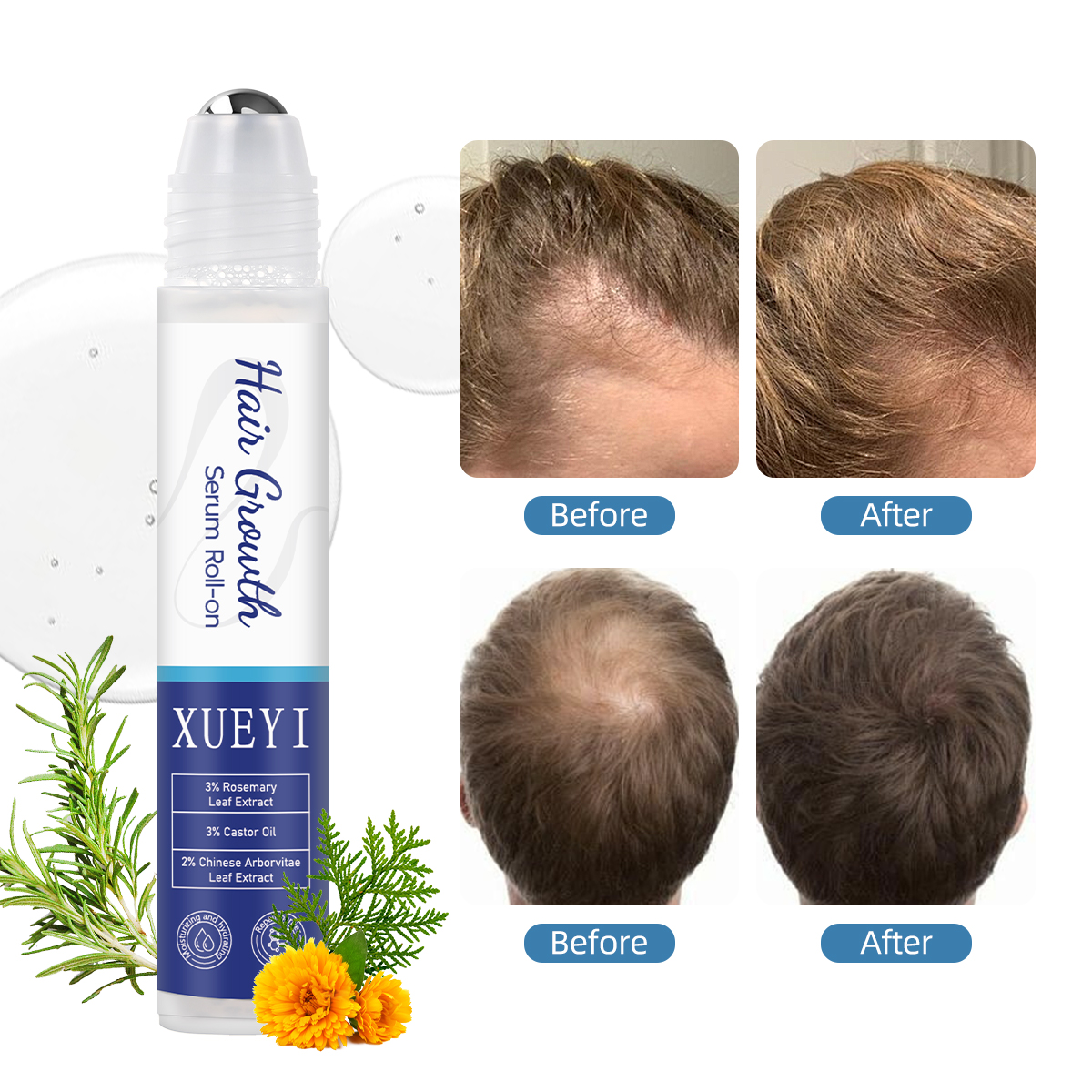 Scalp Roll-on Essence