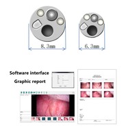 Caméra endoscopique à prix d'usine, endoscopie gastro-intestinale, endoscope vidéo 6,3 mm, endoscope vétérinaire pour chien et chat