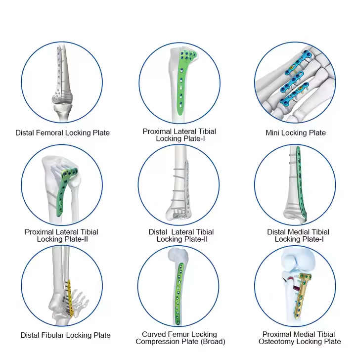 Titanium LCP Mini & Micro Fragment Locking Plate System 1.5/2.0/2.4 mm Modular Fixation Set for Trauma Reconstruction