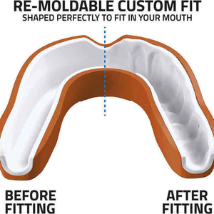 Protège-dents de boxe réversible, écologique et très vendu, produit essentiel - Product Image 4