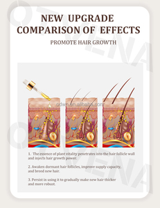 Otvena น้ำมันปลูกผมธรรมชาติซ่อมแซมผมให้เรียบศีรษะป้องกันผมร่วงฉลากส่วนตัว - Product Image 5