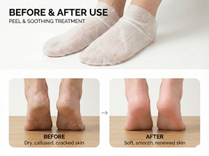 Masque pour les pieds en tissu biologique, marque privée OEM ODM, pour femmes, approvisionnement en vrac, prix d'usine, emballage personnalisé, soin des pieds en spa, CPNP - Product Image 6