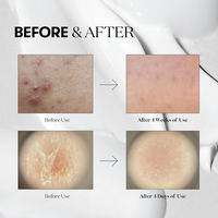 Sérum Visage Coréen Naturel pour Soin de la Peau, Centella Apaisant et Réparateur, Sérum Microneedling pour le Visage, Marque Privée