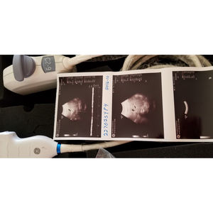 C2-9-D untuk <span class=keywords><strong>GE</strong></span> Logiq E9/Logiq S8/<span class=keywords><strong>Vivid</strong></span> E95/<span class=keywords><strong>Vivid</strong></span> E9 baru kompatibel dengan Array Convex Sensor transduser ultrasonik Probe <span class=keywords><strong>Ultrasound</strong></span> - Product Image 2