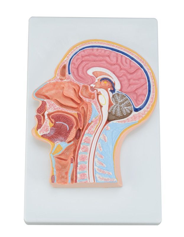 Human Head With Cerebral Artery Model