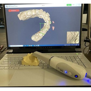 เครื่องสแกนภายใน carestream CS 3600 - Product Image 5