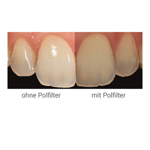 Smile Line Smile Lite - Product Image 2