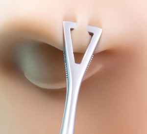 คู่มือชุดเครื่องมือปากคีบเพนนิงตันแบบมีร่อง ทำจากสแตนเลส - Product Image 6