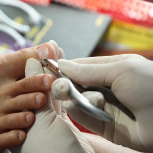 Ongles Et Les Ongles Pinces Pour Épais Et Incarnés Ongles, Cuticules Pousse Et Pinces Avec Pas Cher Prix Et Faible QUANTITÉ MINIMALE DE COMMANDE - Product Image 5