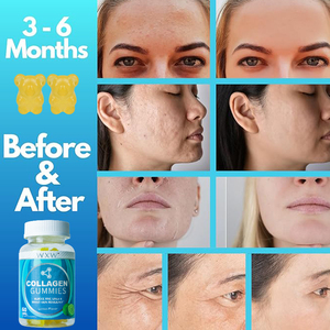 Gomitas de Colágeno Naturales Personalizadas, Suplemento para el Cuidado de la Piel, a Base de Plantas, Sin OMG, Apoyo para la Salud de las Articulaciones - Product Image 3