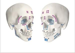 Instrumento quirúrgico maxilofacial, instrumentación de trocar transbucal, nombres de instrumentos quirúrgicos ortopédicos. - Product Image 2