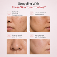 Soins de la peau coréens OEM 30ml Acide hyaluronique Niacinamide 10% + TXA 4% Sérum anti-taches Sérum correcteur d'hyperpigmentation Sérum éclaircissant
