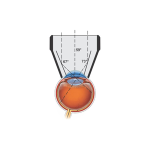 Ojo oftálmico Examen de retina Tres 3 Lentes de espejo Lentes de gonioscopio Lámpara de hendidura para pruebas de ojos - Product Image 2