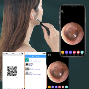 Pulitore Auricolare Smart con WiFi e Telecamera, Rimuovi Cerume in Acciaio Inossidabile e Plastica, Endoscopio per Uso Domestico, Compatibile con Spine USA e CN - Product Image 4