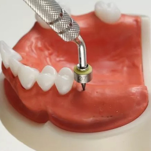 Juego completo de implantes dentales: SSG3 + guía de perforación de implante Y + marcador de implante Y - Product Image 6
