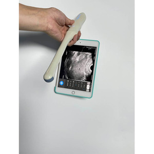 Scanner endovaginal médical pour femmes sonde à ultrasons Doppler couleur transvaginale sans fil - Product Image 5