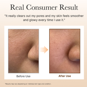 Limpiador Facial Vegano Blanqueador Arencia Calendula Rice Mochi con Aloe Vera, Vitamina C, Té Verde, Eliminador de Puntos Negros, Anti-Inflamación, 120g - Product Image 6