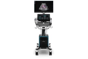 Sistema de Diagnóstico por Imágenes de Ultrasonido Portátil Premium con IA Avanzada, Escáner Médico Doppler para Radiología y Cardiología - Product Image 2