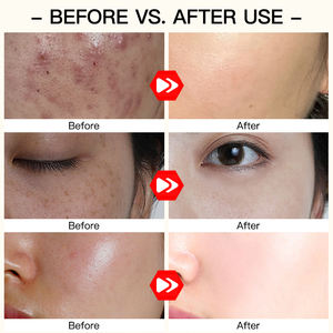 Бесплатный образец: Тонер с куркумой и центеллой для удаления темных пятен и акне, OEM/ODM, осветляет и устраняет пятна, волшебный отбеливающий тонер. - Product Image 4